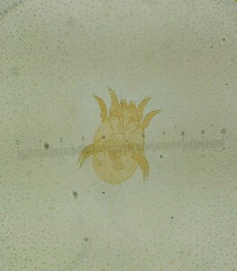 scabies mite